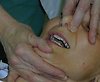 The algorithm describes a real situation of a toxic reaction to local anesthetic at the dentist. It...