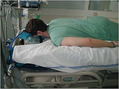 Letální průběh sepse při pneumonii u morbidně obézního pacienta