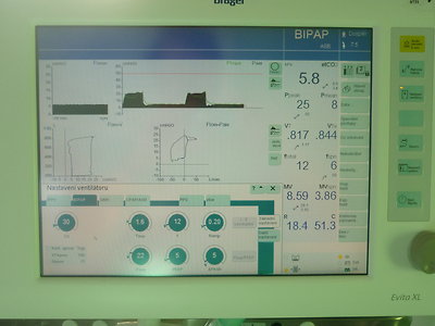 Letální průběh sepse při pneumonii u morbidně obézního pacienta