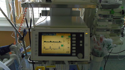 Urosepse s nasedající bronchopneumonií