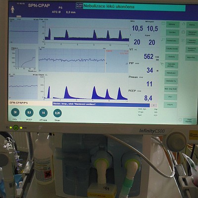 Sepse při peritonitidě - subhepatální absces