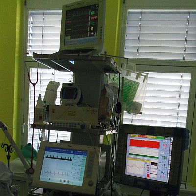 Sepse při peritonitidě - subhepatální absces